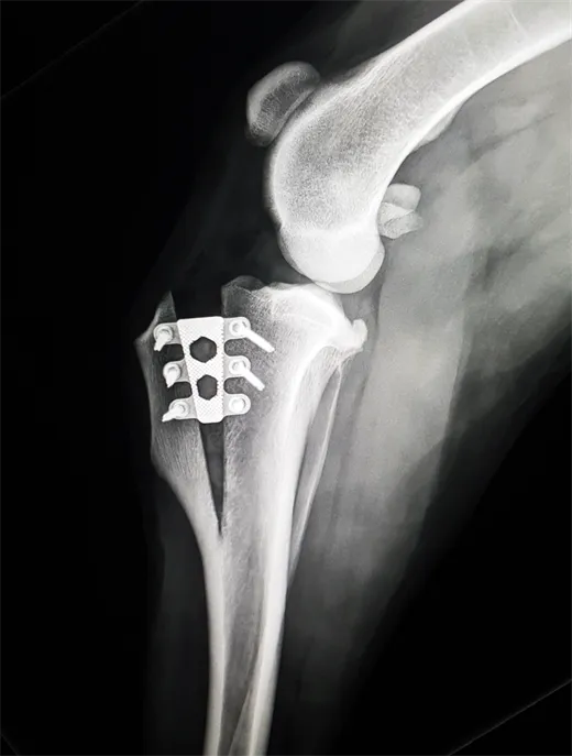 TTA X-Ray_Right Leg PO (Carolien Huismann-Wildeman)_2023 Catalog_