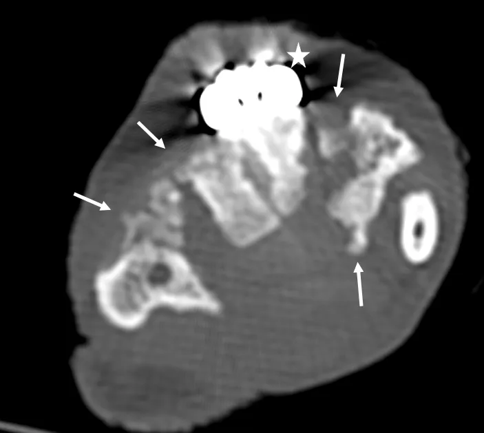 Figure 3-CT control 7